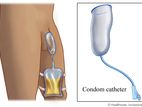 Condom Catheter