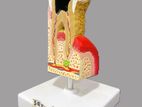 Diseased Tooth Model with Base A542