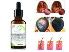 Essantial Hair Loss - Oil -Recovers