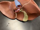 Liver Model A469