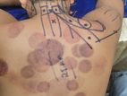 Sport Massage Therapy