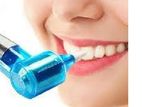 Tooth Whitenning Polisher - LUMA SMILE