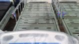 Two Function Manual Hospital Beds