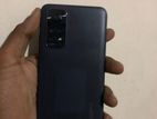 Xiaomi Redmi Note 11 (Used)